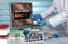 Mi az a szeronegatív cöliákia? - Negatív szerológia esetén gluténérzékeny?